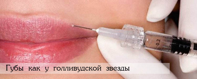 губы как у звезды