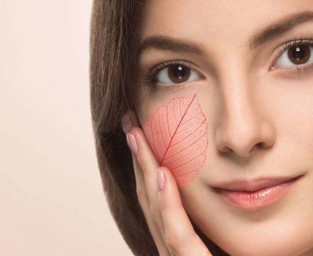 Что такое купероз и как его вылечить